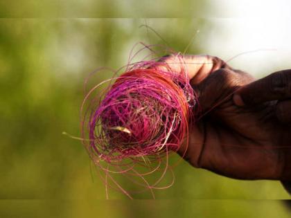 Bike rider seriously injured as nylon manja stuck in his neck; got 20 stitches on throat and fingers cut | पतंगाचा मांजा ठरला २० टाक्यांसाठी कारणीभूत; दुचाकीचालकाचा गळा अन् हाताची बोटे चिरली