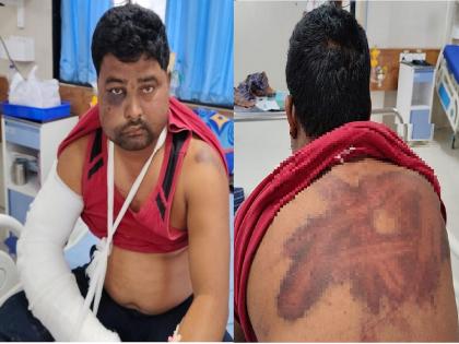height of hooliganism, a fatal attack on a former sarpanch | गुंडगिरीचा कळस! माजी सरपंचावर जीवघेणा हल्ला; लाेखंडी राॅड, स्टंपने २२ मिनिटे मारहाण height of hooliganism, a fatal attack on a former sarpanch | गुंडगिरीचा कळस! माजी सरपंचावर जीवघेणा हल्ला; लाेखंडी राॅड, स्टंपने २२ मिनिटे मारहाण