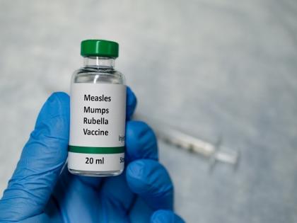 Has your baby been vaccinated against measles? Medical department's call to care | तुमच्या बाळाला गोवरची लस दिली का? काळजी घेण्याचे वैद्यकीय विभागाचे आवाहन