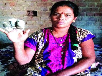  The company picked up the burden of her 'treatment, relative satisfied | ‘तिच्या’ उपचाराचा भार कंपनीने उचलला, नातेवाईक समाधानी