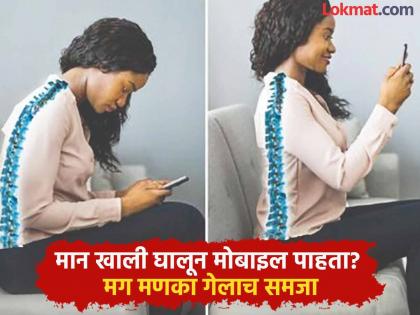 Looking at your mobile with your neck down? Then suppose the spine is gone; Surgery on the young is a shame | मान खाली घालून मोबाइल पाहता? मग मणका गेलाच समजा; तरूणांवर शस्त्रक्रियेची नामुष्की