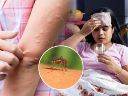 in mumbai there is a fever not an infection the number of malaria and dengue patients in the city is significant  | ताप आलाय, संसर्ग तर नाही ना ! शहरात मलेरिया, डेंग्यू रुग्णांची संख्या लक्षणीय 