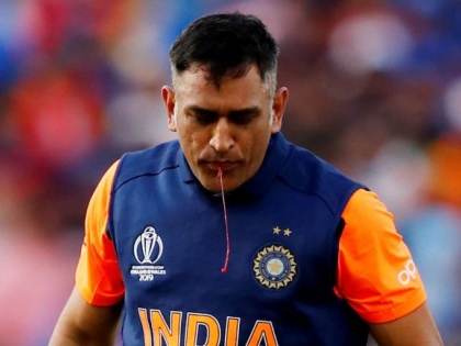 Mahendra Singh Dhoni has been away from the team because of his 'injury' | महेंद्रसिंग धोनी 'या' दुखापतीमुळे राहतोय संघापासून लांब