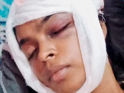Mumbai: Airoli man breaks into home, assaults woman over dog poop | Mumbai: कुत्र्यावरून पेटला वाद, शेजारी राहणाऱ्या नर्सच्या डोक्यात घातला दगड, एरोलीतील घटना! Mumbai: Airoli man breaks into home, assaults woman over dog poop | Mumbai: कुत्र्यावरून पेटला वाद, शेजारी राहणाऱ्या नर्सच्या डोक्यात घातला दगड, एरोलीतील घटना!