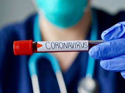 Corona virus in Nagpur: 17 patients die in Nagpur | CoronaVirus in Nagpur : नागपुरात १७ रुग्ण, दोघांचा मृत्यू