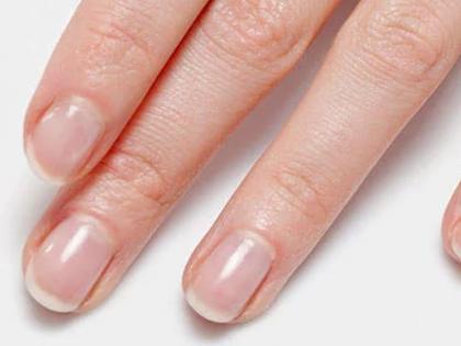 Nails tell about your overall health | तुमच्या नखांमधील बदल सांगतात तुमच्या आरोग्याबाबत हे संकेत!