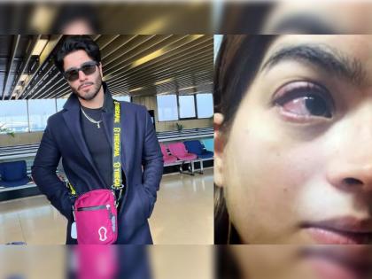 bollywood pakistani actor Feroze Khan beated his wife Aliza Sultan brutally heart wrenching photos viral | धक्कादायक! डोळ्याला गंभीर इजा, हातावर जखमांचे व्रण; प्रसिद्ध अभिनेत्याची पत्नीला बेदम मारहाण