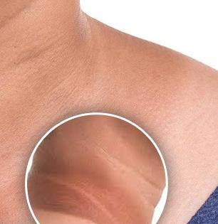 मानेवर काळे डाग पडले, लांब काळे पट्टे उमटले? टूथपेस्टचा ‘हा’ उपाय करा-दिसेल फरक