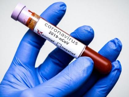 CoronaVirus in Nagpur: 725 positive out of 9443 tests | CoronaVirus in Nagpur : ९४४३ चाचण्यांतून ७२५ पॉझिटिव्ह