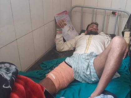 Hospital In Agra Patient Had Problem With Left Leg Doctor Operated On The Right Leg | हद्द झाली! त्रास डाव्या पायाला, पण डॉक्टरांनी उजव्या पायावर केली शस्त्रक्रिया; अन् मग...