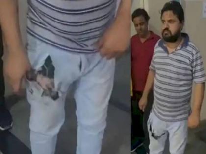 Mobile Kept In Jeans Pocket Cracked And Caught Fire Youths Hands And Feet Were Scorched | बॉम्बसारखा फुटला खिशात ठेवलेला मोबाईल; स्फोटामुळे व्यापाऱ्याची जीन्स जळाली, पाय भाजला