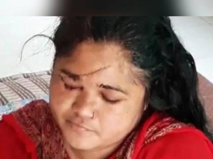 mp bhopal woman objection against lewd comment miscreants hit blade woman face 118 stitches | शेरेबाजीचा विरोध केला अन् थोबाडीत लगावली म्हणून महिलेच्या चेहऱ्यावर ब्लेडनं वार, ११८ टाके!