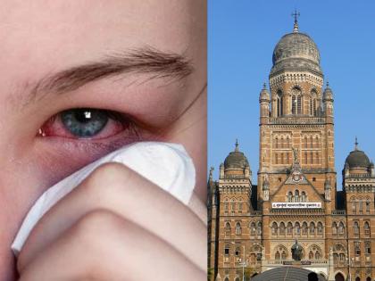 Conjunctivitis in Mumbai Be careful Eye infection in Mumbai get immediate treatment as soon as symptoms are felt bmc appeal | Conjunctivitis in Mumbai: काळजी घ्या! मुंबईत डोळ्याची साथ, लक्षणे जाणवताच तातडीने उपचार करा; पालिकेचं आवाहन