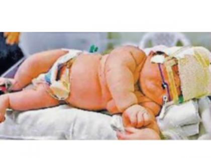 a supersize baby weighing seven kilos two feet tall was born the doctors were also shocked | जन्माला आले सात किलोचे सुपरसाइज बालक, दोन फूट उंची; डॉक्टर मंडळीही झाली हैराण