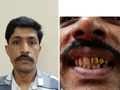 Accused in jail after 15 years due to gold teeth Mumbai police action | सोन्याच्या दातामुळे १५ वर्षांनी आरोपी जाळ्यात, मुंबई पोलिसांची कामगिरी; नेमकं प्रकरण काय वाचा...