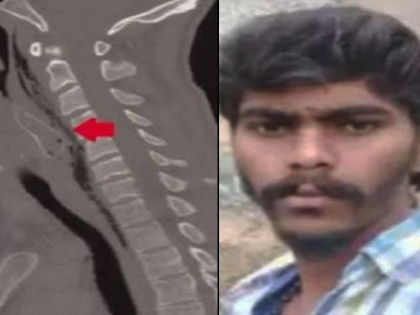 Youth dies as fish gets stuck in throat in tiktok stunt video | धक्कादायक! जिवंत मासा तोंडात टाकून बनवला TikTok व्हिडीओ, घशात अडकल्याने गमावला जीव....