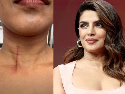 Priyanka Chopra Gets a HUGE Cut on Her Throat While Filming Stunt Scenes For The Bluff; Shares Pic | थोडक्यात वाचली प्रियंका चोप्रा, मानेवर मोठी जखम, 'देसी गर्ल'ची अशी अवस्था पाहून चाहते चिंतेत