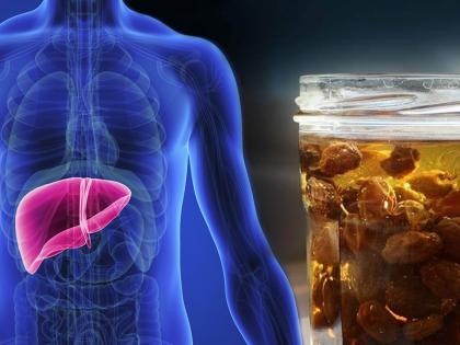 Liver Detox Water : Detox your liver with amazing raisins drink | ३ दिवसात लिव्हर डीटॉक्स करेल मनुक्याचं हे खास पाणी, जाणून घ्या पिण्याची पद्धत आणि कसं कराल तयार