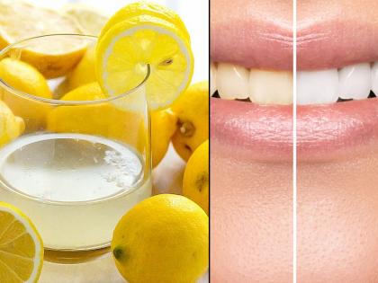 Know why too much of citrus acid is bad for your teeth | रोज लिंबू पाण्याचं सेवन करत असाल तर वेळीच व्हा सावध, तुमच्या स्माइलचे वाचू शकतात तीनतेरा!