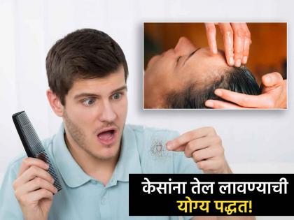 Dermatologist tells right way of applying hair oil for hair growth | केसगळती होऊ नये म्हणून केसांना तेल कसं लावावं? डर्मेटोलॉजिस्टने दिला खास सल्ला