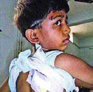 The girl is saved from the jaw jaw | बिबट्याच्या जबड्यातून मुलीला वाचविले The girl is saved from the jaw jaw | बिबट्याच्या जबड्यातून मुलीला वाचविले