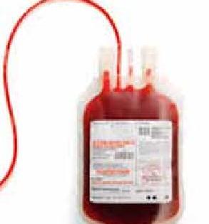 There is no blood transfusion facility | रक्त विलगीकरण सुविधा नाही There is no blood transfusion facility | रक्त विलगीकरण सुविधा नाही