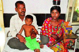 Valley doctors achieve success in removing a stuck in an esophagus | अन्ननलिकेत अडकलेला सेल काढण्यात घाटीच्या डॉक्टरांना यश Valley doctors achieve success in removing a stuck in an esophagus | अन्ननलिकेत अडकलेला सेल काढण्यात घाटीच्या डॉक्टरांना यश