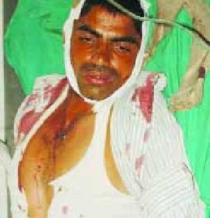 Drunken assassination of the preacher | उपोषणार्थीला बेदम मारहाण Drunken assassination of the preacher | उपोषणार्थीला बेदम मारहाण