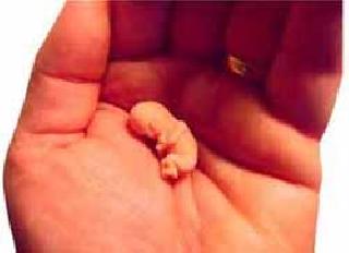 Do not know the value of female feticide in Beed district | स्त्री भ्रूणाचे मोल बीड जिल्ह्याला कळेना Do not know the value of female feticide in Beed district | स्त्री भ्रूणाचे मोल बीड जिल्ह्याला कळेना