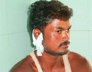 A seriously injured in the leopard attack | बिबट्याच्या हल्ल्यात एक गंभीर जखमी A seriously injured in the leopard attack | बिबट्याच्या हल्ल्यात एक गंभीर जखमी