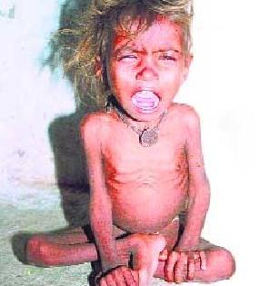 The determination of the hunger of the needy | गरजूंची भूक भागविण्याचा निर्धार The determination of the hunger of the needy | गरजूंची भूक भागविण्याचा निर्धार