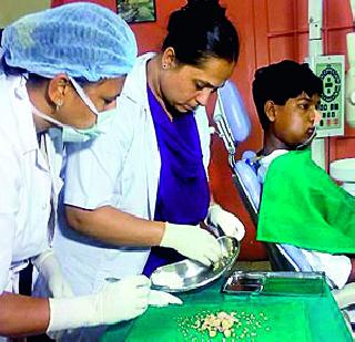 230 teeth removed from the jaw of a 17-year-old man | 17वर्षीय तरुणाच्या जबडय़ातून काढले 230 दात