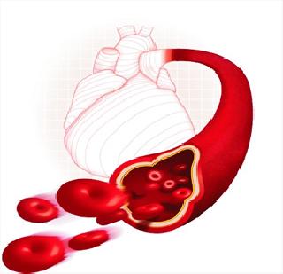 40% of cardiovascular diseases | 40 टक्के हृदयरुग्णांना रक्तवाहिन्यांचे आजार