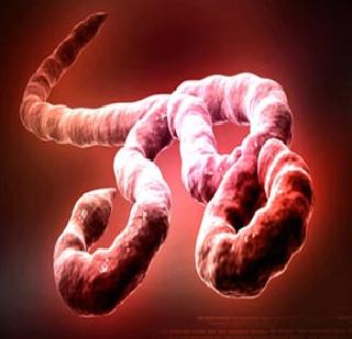 Palika ready for 'Ebola' | ‘इबोला’साठी पालिका सज्ज Palika ready for 'Ebola' | ‘इबोला’साठी पालिका सज्ज