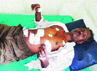 One injured in thieves attack in Dubere Shivar | डुबेरे शिवारात चोरट्यांच्या हल्ल्यात एक जखमी