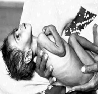 Death of the child's malnutrition in the womb | कळंबमध्ये बालिकेचा कुपोषणाने मृत्यू
