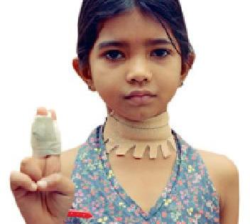 If the thread of life was broken ... | जीवनाचा धागा तुटला असता तर..