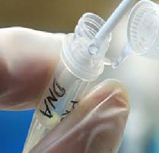 Permission for the accused DNA test | आरोपींच्या डीएनए चाचणीस परवानगी