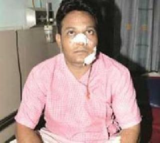 Tulsi attack in Shalimar Express | शालीमार एक्स्प्रेसमध्ये टीसीवर हल्ला Tulsi attack in Shalimar Express | शालीमार एक्स्प्रेसमध्ये टीसीवर हल्ला