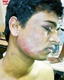 Traffic police's youth beat them severely | वाहतूक पोलिसांची युवकाला बेदम मारहाण Traffic police's youth beat them severely | वाहतूक पोलिसांची युवकाला बेदम मारहाण