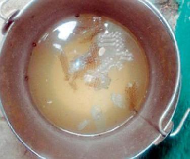 Groundwater supply from Benoda Gram Panchayat | बेनोडा ग्रामपंचायतीकडून गढूळ पाण्याचा पुरवठा Groundwater supply from Benoda Gram Panchayat | बेनोडा ग्रामपंचायतीकडून गढूळ पाण्याचा पुरवठा