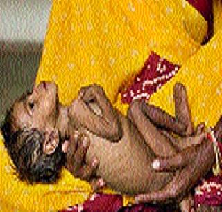 105 children in malnutrition free from malnutrition | मावळात १०५ बालके कुपोषणमुक्त 105 children in malnutrition free from malnutrition | मावळात १०५ बालके कुपोषणमुक्त