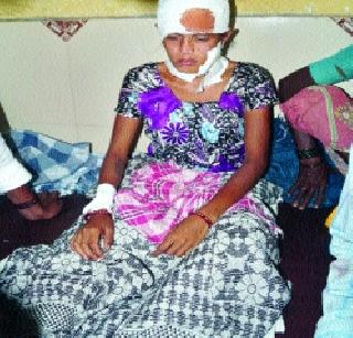 The woman was injured in a leopard attack | कसाऱ्यात बिबट्याच्या हल्ल्यात तरुणी जखमी