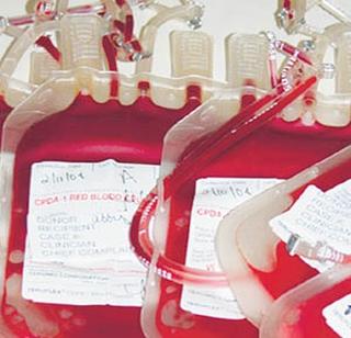 Hanging in Nagpur's blood banks; Store for two to three days | नागपुरातील रक्तपेढ्यांमध्ये ठणठणाट ; दोन-तीन दिवस पुरेल एवढाचा साठा