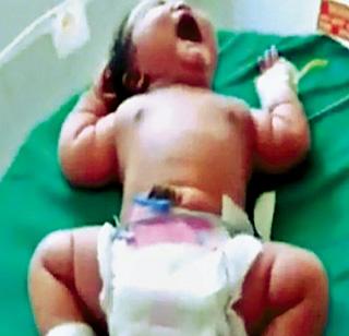 The highest child born in India! | भारतात जन्मले सर्वाधिक वजनाचे बाळ!