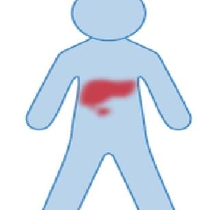 Successful hepatic implants on a 2-year-old child | अडीच वर्षांच्या मुलावर यशस्वी यकृत प्रत्यारोपण