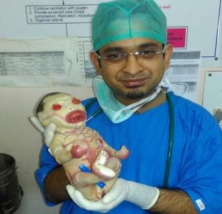 Baby born with 'genetic disorder' in Nagpur | नागपूरमध्ये जन्माला आले 'जेनेटिक डिसऑर्डर' असलेले बाळ