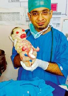 The birth of the child 'Harqilain' in Nagpur | नागपुरात ‘हरक्विलीन’ बाळाचा जन्म The birth of the child 'Harqilain' in Nagpur | नागपुरात ‘हरक्विलीन’ बाळाचा जन्म