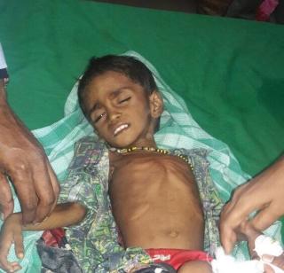 Family of malnutrition, incident in Jawhar .. | कुपोषणाला जाबाबदार कुटुंबच, जव्हारमधील घटना..