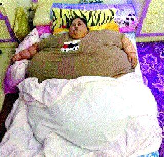 88 Stone of Iman Ahmed's body | इमान अहमदच्या शरीरात ७८ स्टोन